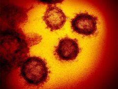 Fumata nera sul fondo degli amministratori comunali a favore dell’emergenza coronavirus Fumata nera sul fondo degli amministratori comunali a favore dell’emergenza coronavirus